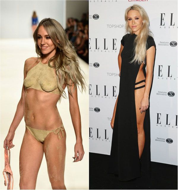 Em nome da perfeição o corpo torna-se imperfeito